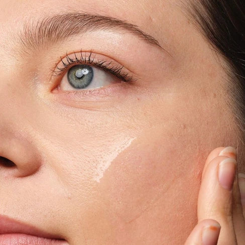 The Ordinary - Niacinamide 10% + Zinc 1% 30 ML